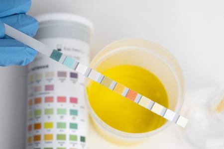 اهمیت pH در فرآوری مواد معدنی